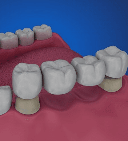 Treatment - Cosmetic & Family Dentistry