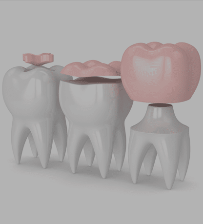 Treatment - Cosmetic & Family Dentistry