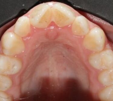 Before - Cosmetic & Family Dentistry