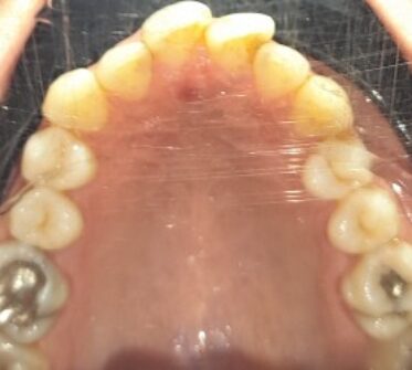 Before - Cosmetic & Family Dentistry